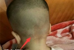 胎儿体型大（宝宝的额头比较突出正常吗）