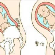 胎儿臀位胎动在哪里（胎儿臀位胎动在哪里动）