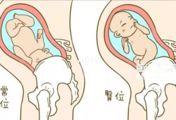 胎儿臀位胎动在哪里（胎儿臀位胎动在哪里动）