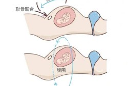 胎儿入盆自己怎么摸（胎儿进入产道怎么知道）