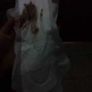 怀孕期间出血是黑色的（怀孕了一直有褐色的血怎么回事）