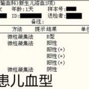 胎儿溶血症（胎儿溶血症是什么意思）