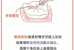 祁阳话窝血什么意思,孕妇窝血怎么办