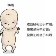 胎儿头大腿短是畸形吗（胎儿头大腿短是畸形吗图片）