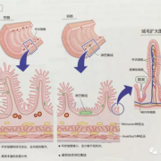 肠上皮的结构特点,胎儿肠外漏导致原因