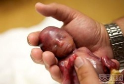 72天胎儿图片（72天的胎儿）