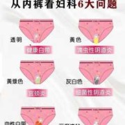 孕期细菌性阴炎怎么办（细菌阴道炎要怎么治）
