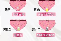 孕期细菌性阴炎怎么办（细菌阴道炎要怎么治）