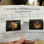 孕期彩超需要空腹吗（彩超不能吃东西吗）