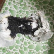 孕期拉黑屎（孕晚期贫血补铁大便怎么是黑色的，这是正常现象吗）