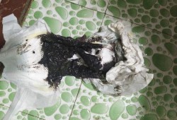 孕期拉黑屎（孕晚期贫血补铁大便怎么是黑色的，这是正常现象吗）