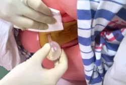 开塞露对胎儿有影响吗（孕早期用了开塞露对胎儿有影响吗）