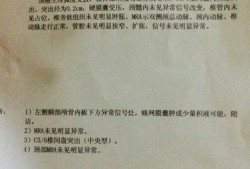 宝宝的室管膜下囊肿怎么样了,胎儿囊肿会自己消失吗吃什么消失的快