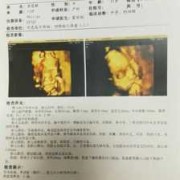胎儿偏小五天（胎儿偏小五天正常吗）
