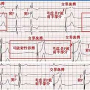 胎儿心率失常（胎儿心率失常是什么原因引起的）