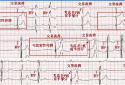 胎儿心率失常（胎儿心率失常是什么原因引起的）