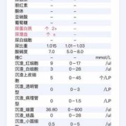 孕期尿检指标（孕期尿检指标怎么看）