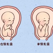 胎儿在肚子里翘屁股图（胎儿在肚子里翘屁股图片大全）