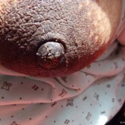 产妇乳头皲裂怎么,孕期乳头干裂是什么原因造成的