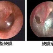 胎儿的耳膜（胎儿的耳膜什么时候发育）