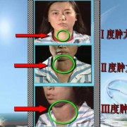 甲亢会遗传给宝宝吗,胎儿遗传谁的基因更多