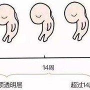 胎儿颈部透明层正常值（我34岁，怀孕12+4，胎儿颈后皮下透明度厚4.5mm请问有什么好的建议）