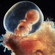 怀孕8周的胎儿图片（怀孕8周的胎儿图片 真实）