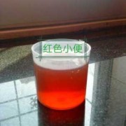 孕期尿偏红色是怎么回事,孕期尿液偏红什么原因引起的