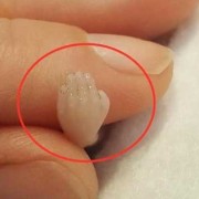 胎儿图片高清（胎儿图片高清）