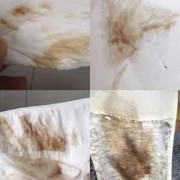 孕期白带有点褐色（白带中带褐色是怎么回事。该怎么治疗）