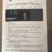 胎儿心胸比增大（胎儿心胸比增大）