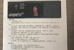 胎儿心胸比增大（胎儿心胸比增大）