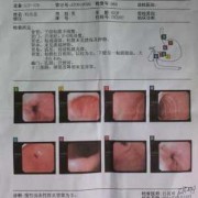 孕期一月之内吃治疗胃炎的药怎样做检查排除胎儿畸形,孕期胃炎犯了怎么办