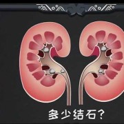 我老婆怀孕6个月查出左肾积水是怎么回事,孕妇肾积水最快最好的治疗方法