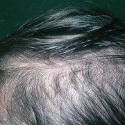孕期不长头发（头发好象没有发根是为什么）