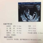 孕期12（孕12周正常表现是什么）