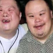 怀唐氏儿的孕妇有什么症状,唐氏儿孕妇回忆孕期症状贴吧