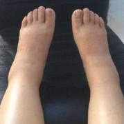 怀孕脚会变大吗为什么呢,孕期脚会变大吗?