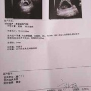 50天胎心不稳定咋回事,胎心不稳对胎儿的影响有哪些