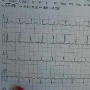 孕期心脏跳的快（胎儿心率快怎么回事）