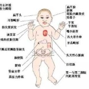 什么叫唐氏综合症,孕期综合症的表现怎么调节