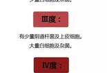 孕期白带清洁度4怎么办（孕晚期白带化验出清洁度4，该怎么治疗）