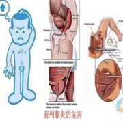 前列腺炎对胎儿有影响吗,前列腺炎会影响胎儿吗