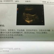 怀孕7周胚芽大小标准值是多少的,胎儿周图片