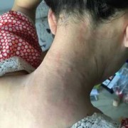 孕妇身上很痒是怎么回事,孕期身上痒怎么回事儿