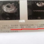 胎心胎芽是什么样的,胎儿胎心胎芽出现时间