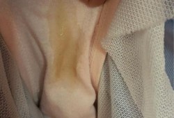 孕期白带发黄不痒（怀孕八周白带有点黄是怎么回事）