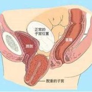 孕期子宫下垂图片（孕妇下坠感是什么感觉）