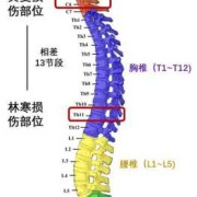 胎儿脊柱排列不整齐孩子还能要吗,胎儿腰椎缺失怎么办