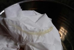 孕期白带糊状（白带糊状像酸奶一样，真的好希望我可以快点好起来）